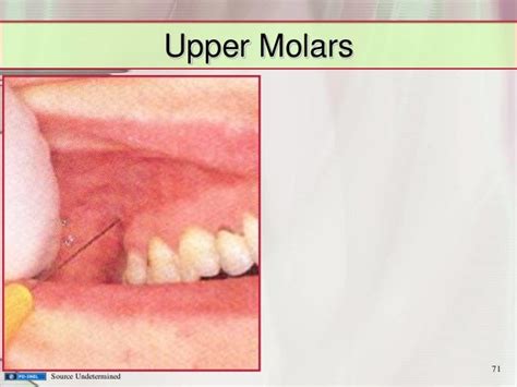 Gemc Dental Emergencies And Common Dental Blocks Resident Training