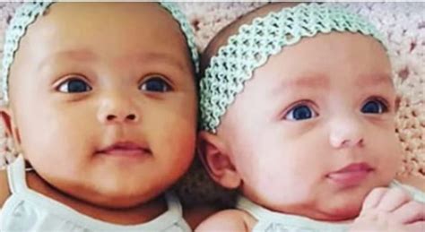 Mom Gave Birth To Twins Of Different From Each Other 7 Years Later