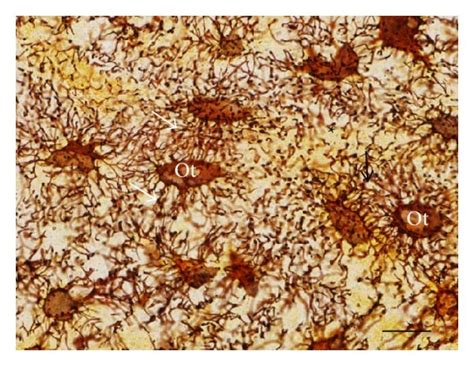 Light A And B And Electron Micrographs Of Portions Of Alveolar Bone