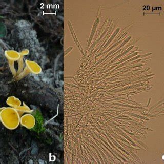 Rhodoscypha Ovilla A Ascocarps B Asci C Ascospores In A Portion Of