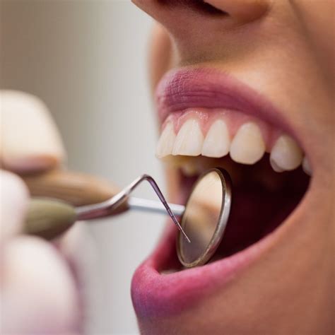 ¿qué Es La Obturación Dental • Clínica Dental Avodent