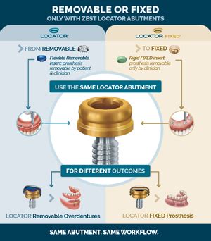 How Does LOCATOR FIXED Work V2