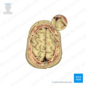 Pia: anatomy, definition, function and location | Kenhub