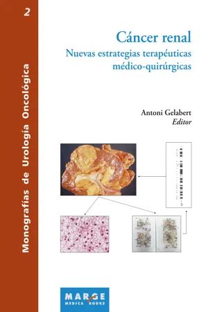 PDF Cáncer renal Nuevas estrategias terapeuticas medico quirurgicas