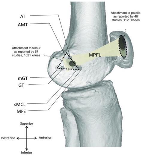 Patellofemoral Instability Intechopen