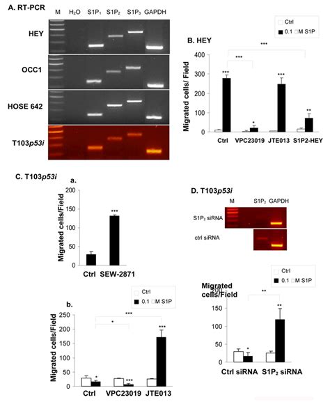 The Role Of S1P Receptors In Migration Of EOC And HOSE Cells A S1P