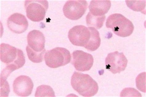 hypogranular platelet atlas : Biological Science Picture Directory ...