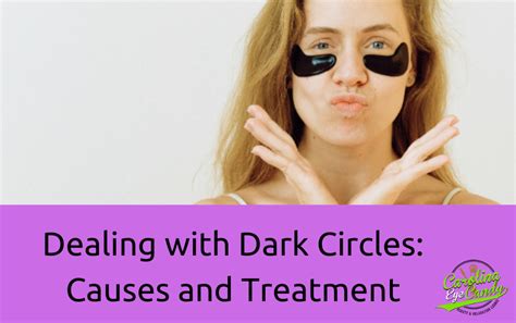 Dealing with Dark Circles: Causes and Treatment | Carolina Eye Candy