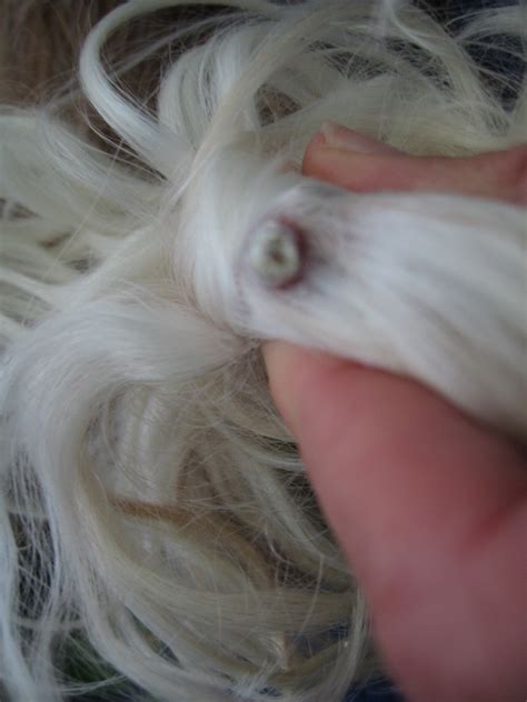 Cutaneous Horn – Welshies – Hal, Zen & Derwyn