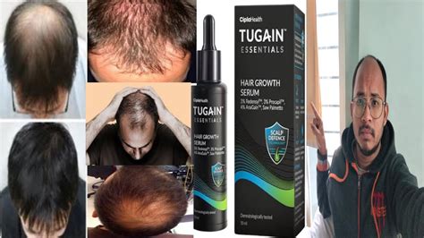 Don T Use Tugain Essentials Hair Growth Serum Honest Review Youtube