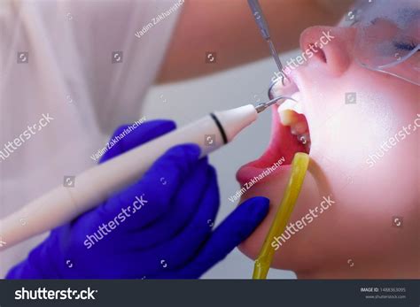 Dental Hygienist Makes Ultrasonic Cleaning Teeth Stock Photo 1488363095 | Shutterstock