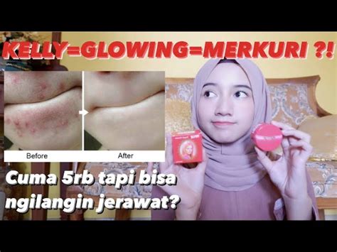 Temukan Manfaat Cream Kelly Untuk Jerawat Yang Jarang Diketahui Biotifor