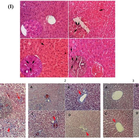 I Effects Of Silymarin And Silymarin Phytosome On Histopathological