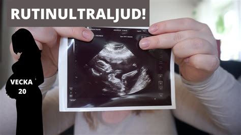 ULTRALJUD Gravid Vecka 20 YouTube