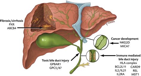 Figure 2 From Genetics In Primary Sclerosing Cholangitis Semantic Scholar