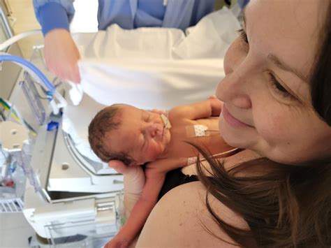 Watch A C Section Delivery St Lukes Birthing Center