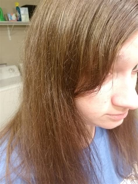 Breakage Split Ends How Can I Fix Or Manage This Stop Hair