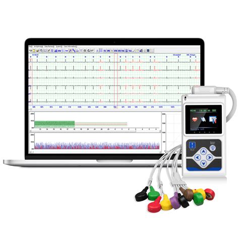 chest based electrical heart rate tracking   accurate