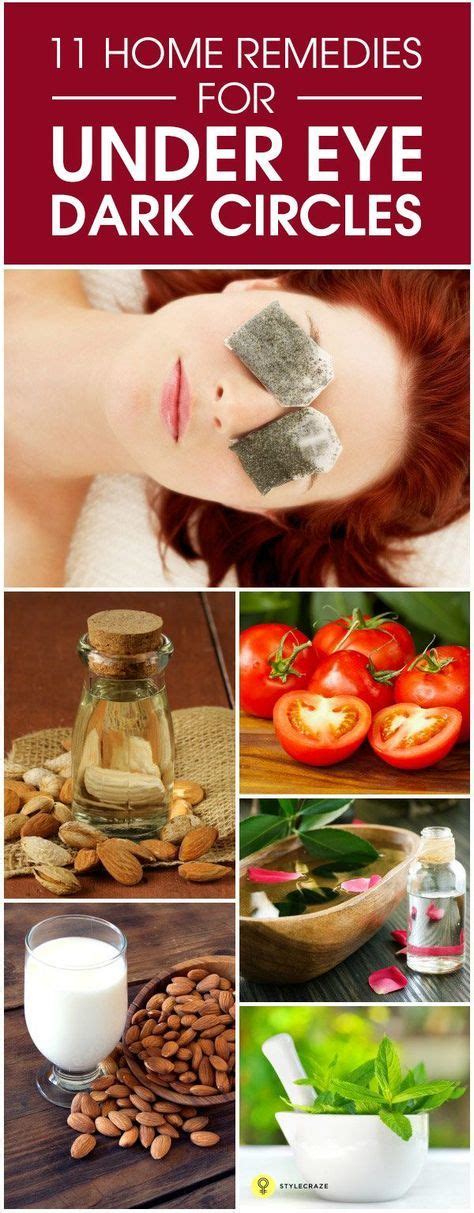 13 Natural Ways To Treat Dark Circles Under The Eyes At Home Dark Circles Dark Circles Under