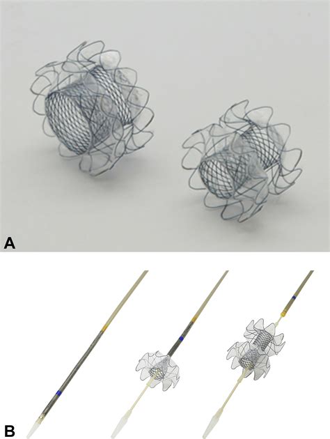 Lumen Apposing Metal Stents With Videos Gastrointestinal Endoscopy