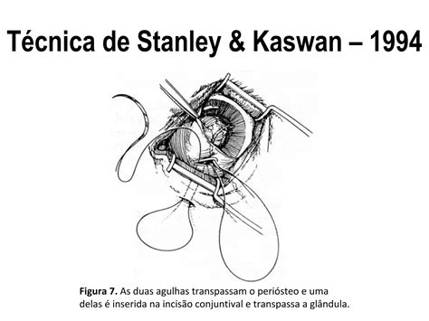 Prolapso de Terceira Pálpebra Tecnica Cirurgica PPT