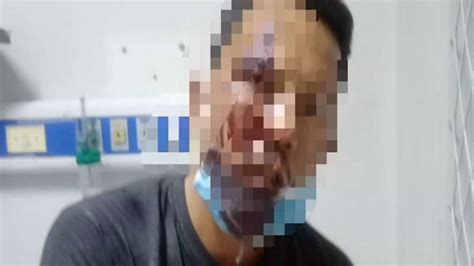 Foto Driver GoCar Dihajar Polisi Muda Sampai Babak Belur