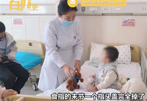 兔子急了真咬人！1岁女童和家养小兔玩耍被咬掉手指尖