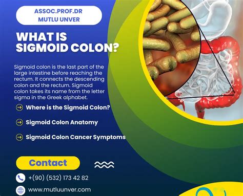 sigmoid colon cancer prognosis