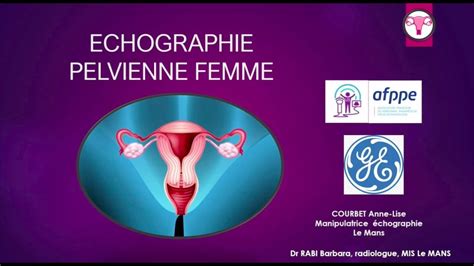 Echographie Pelvienne Femme Trucs Et Astuces Pour D Buter Manip To