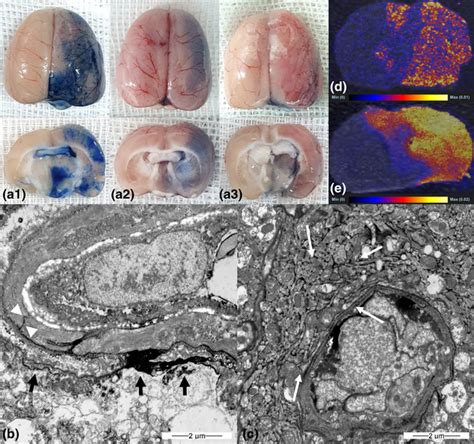 Gross Finding Of Trypan Bluestained Whole Brain A1 B1 And C1 And