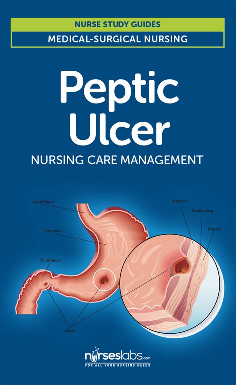 Peptic Ulcer Disease Nursing Care And Management Study Guide Artofit