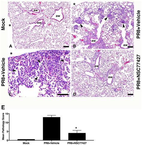 Grp Inhibitor Nsc Reduces Lung Pathology After Influenza Pr