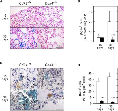 A Synthetic Lethal Interaction Between K Ras Oncogenes And Cdk Unveils