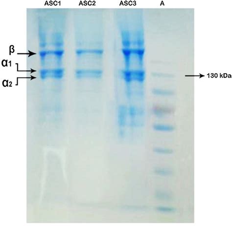 Sds Page Pattern Of Three Samples Of Acid Soluble Collagen Extracted