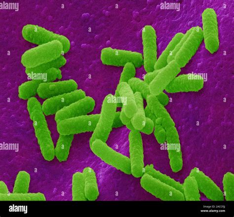 E Coli Bakterien Farbige Scanning Electron Micrograph Sem Von Escherichia Coli E Coli