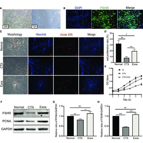 Characterization And Identification Of Hucmscs And Hucmsc Exos A