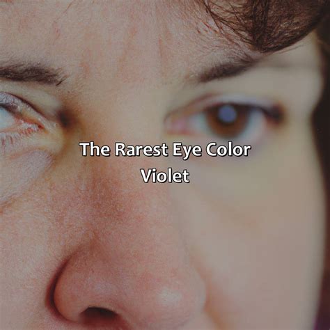 What Is The Rarest Eye And Hair Color Combination In The World