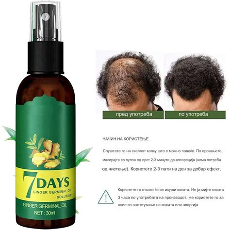 7days Ginger – Масло од ѓумбир за раст на коса – BrzShopping