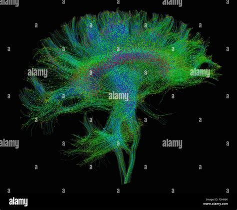 Diffusion Tensor Imaging Fotograf As E Im Genes De Alta Resoluci N Alamy