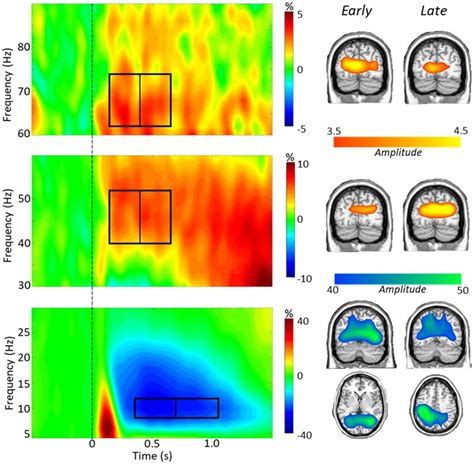 Task switch spectrograms. Left: Grand-averaged time-frequency ... 