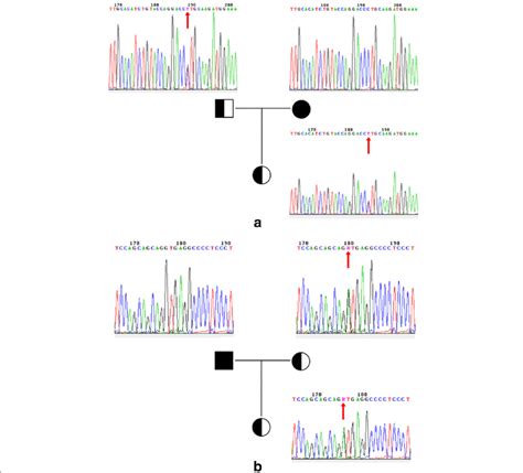 Mutations In UNC13D Gene A Novel Splicing Mutation C 1299 1G A In