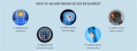 MRI Brain Scan - Aarthi Scans and Labs