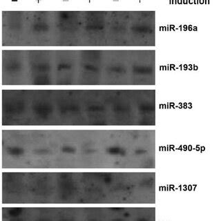 Northern Blot Analysis Confirmation Of Mirna Expression In Human