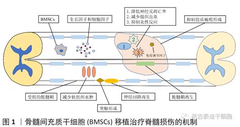 干细胞移植治疗神经系统疾病方案 杭吉干细胞科技