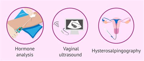 Types Of Hysterosalpingography Advantages Risks And Limitations