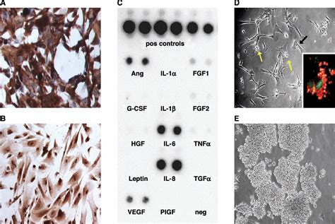 Figure From Fetal Stromal Dependent Paracrine And Intracrine Vascular