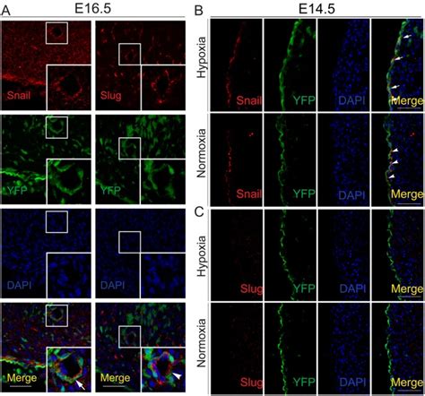 Hypoxia Induced The Differentiation Of Tbx18 Positive Epicardial Cells