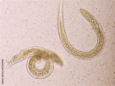 Strongyloides Stercoralis Or Threadworm In Human Stool Analyze By Microscope Original