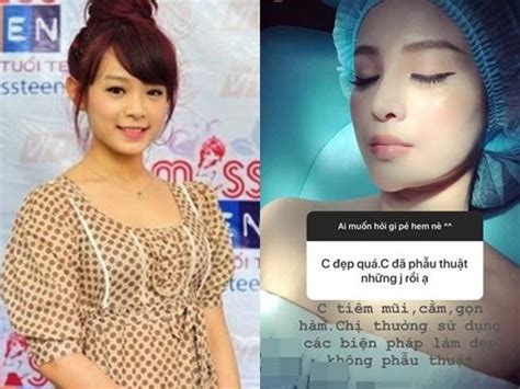 Hot girl Huyền Baby thay đổi 180 độ sau 10 năm là can thiệp 2sao