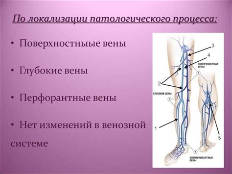 Варикозная болезнь нижних конечностей - презентация онлайн